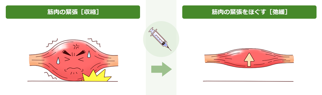 筋肉の[収縮]と[弛緩]