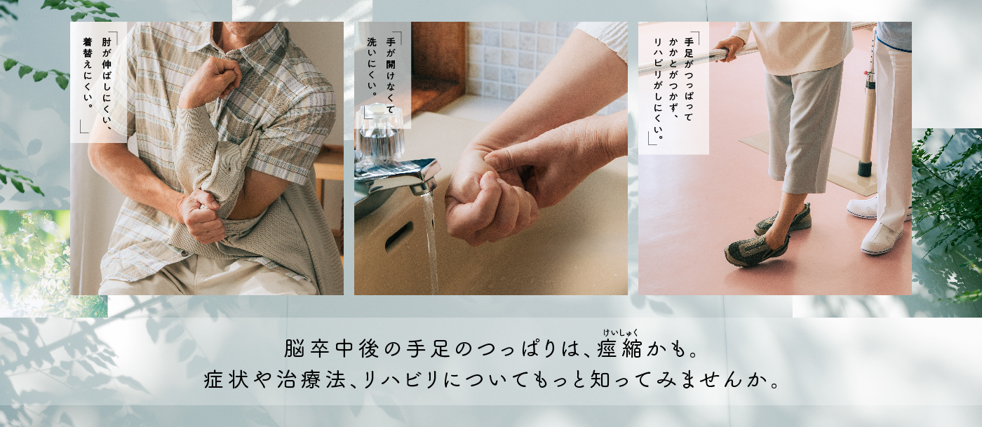「肘が伸ばしにくい、着替えにくい。」「手が開けなくて洗いにくい。」「手足がつっぱってかかとがつかず、リハビリがしにくい。」脳卒中後の手足のつっぱりは、痙縮かも。症状や治療法、リハビリについてもっと知ってみませんか。