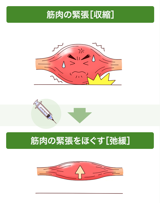 筋肉の[収縮]と[弛緩]